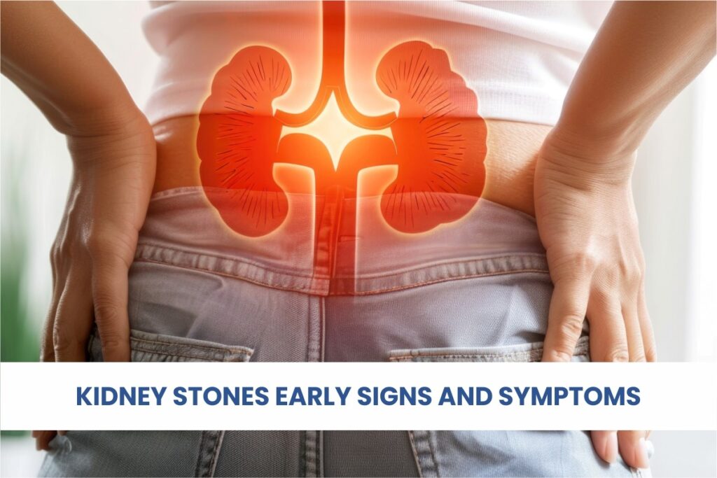 KIDNEY STONES