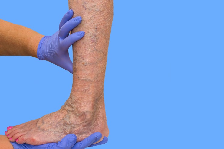 Vascular & Endovascular Surgery